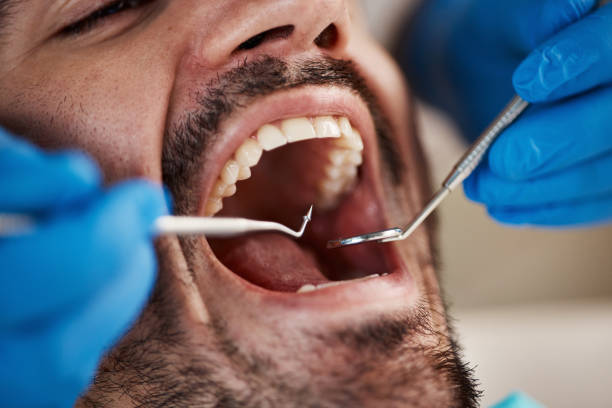 Best Pediatric Emergency Dentist in Eton, GA