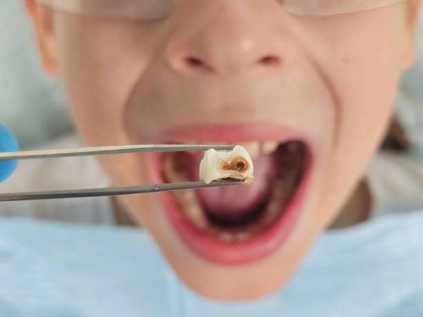 Best Weekend Emergency Dentist in Eton, GA